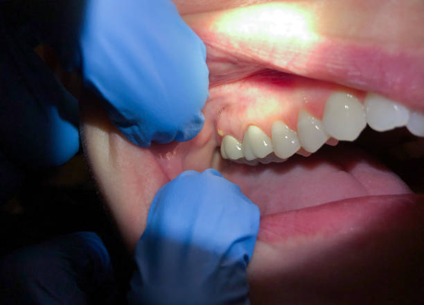 Best Urgent Tooth Repair  in New Boston, TX